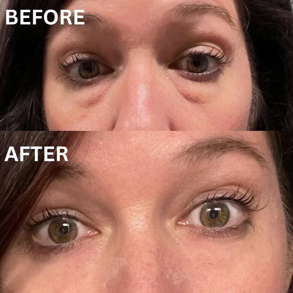 👁️Vaxflite™Eye Transformation Patches👀Collagen Firming Eye Mask