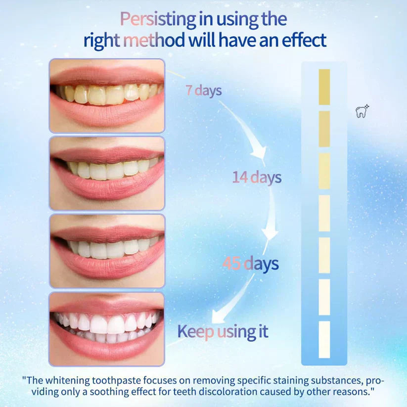 Final Day 65% OFF 🔥 LOVILDS™ Niacinamide Whitening Toothpaste